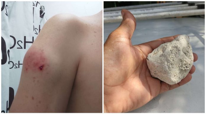 Choferes sufren apedreados en una transitada avenida de La Habana