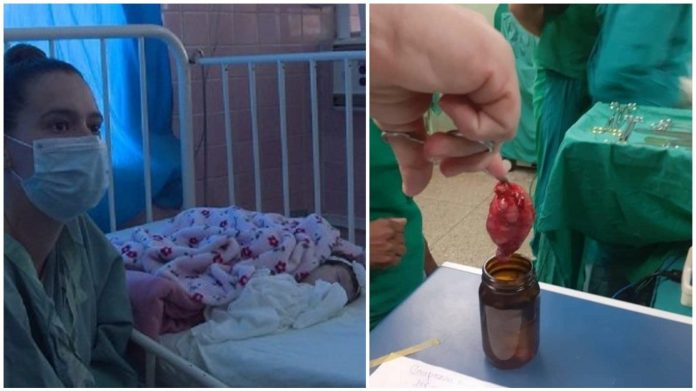 Una bebé milagro!! Médicos en Cuba logran extirpar un tumor del pecho a una bebé de 49 días de nacida